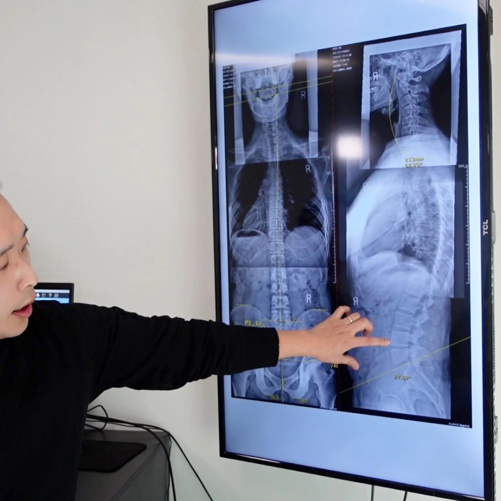 second chiropractic visit in los angeles